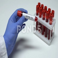 Picture of related test